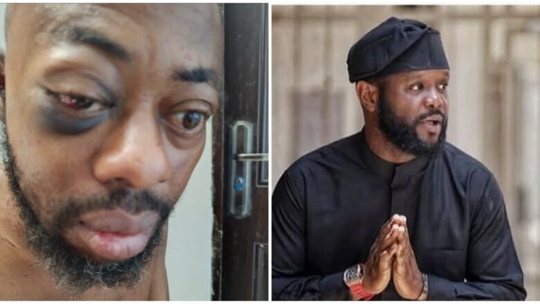 DSS sun kama Shugaban Kungiyar Daliban Najeriya bayan da yayi zargin dan shugaban kasa, Seyi Tinubu yasa an mai dukan kawo wuka